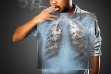 Rentgen płuc palacza nie wykryje wcześnie raka płuc, ale badanie zaleca się co roku dla wykrycia zmian w miąższu płuc lub zbierania się płynu w opłucnej.