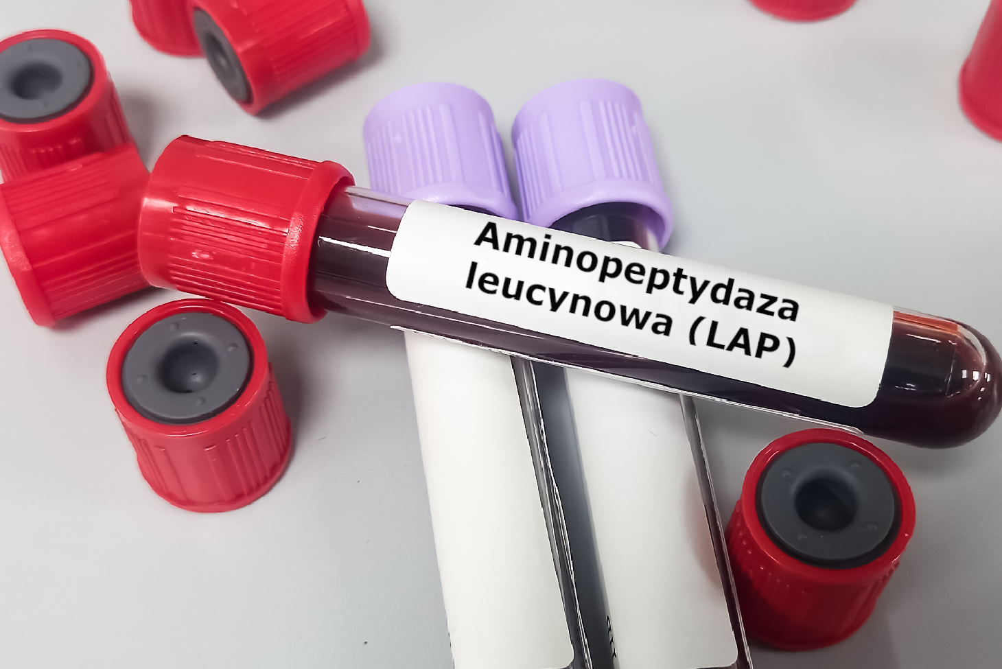 Aminopeptydaza Leucynowa Lap — Na Czym Polega Badanie I Kiedy Je Wykonać Przygotowanie Normy 3005