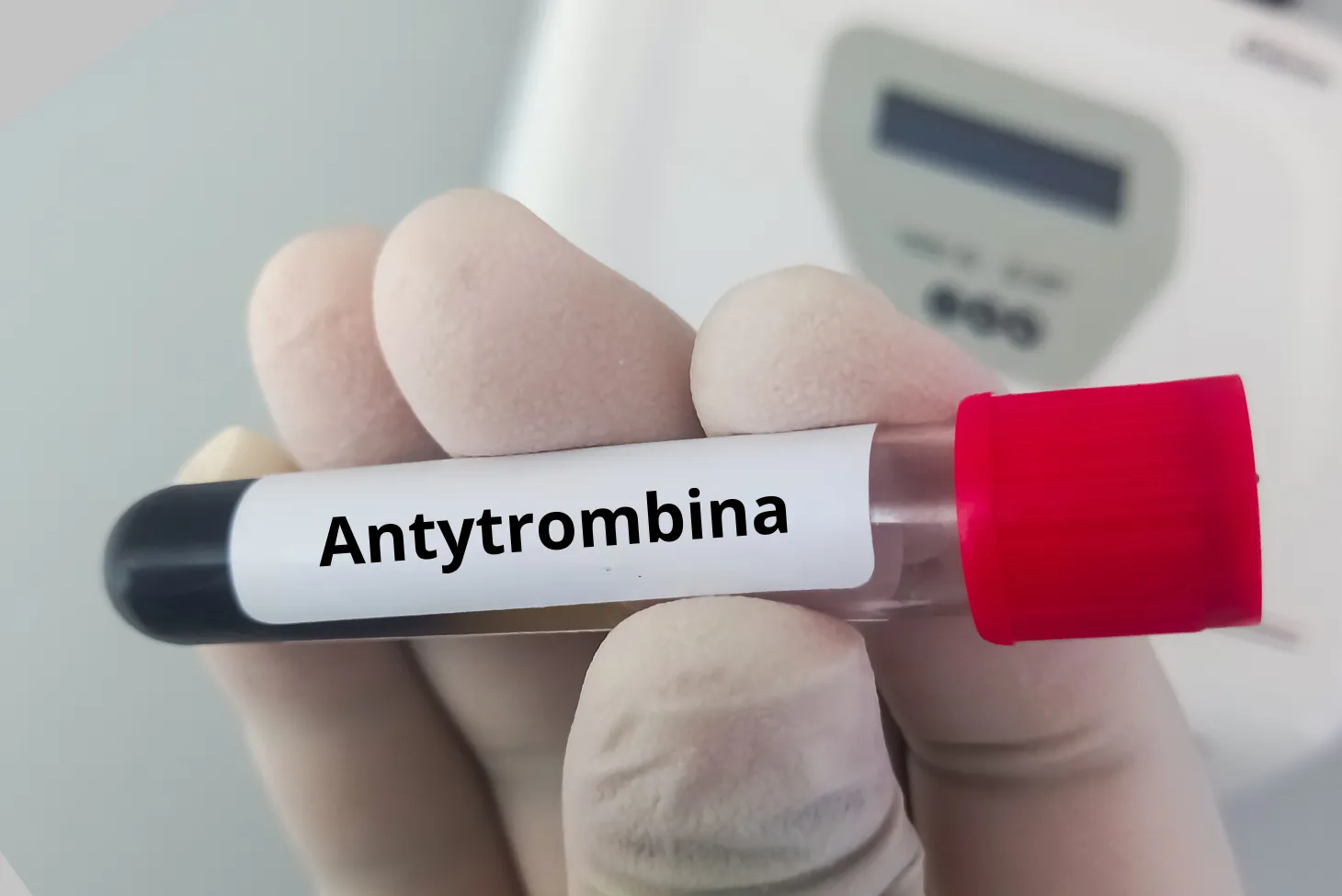 Antytrombina — Na Czym Polega Badanie I Kiedy Je Wykonać Przygotowanie Normy I Interpretacja 7766
